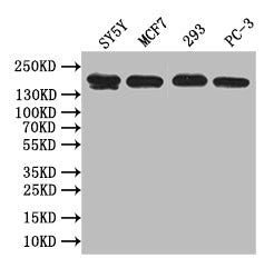 Western Blot
Positive WB detected in: SY5Y whole cell lysate, MCF7 whole cell lysate, 293 whole cell lysate, PC-3 whole cell lysate
All lanes: ABCA3 antibody at 1:1000
Secondary
Goat polyclonal to rabbit IgG at 1/50000 dilution
Predicted band size: 192 kDa
Observed band size: 192 kDa
