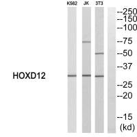 Western blot analysis of extracts from K562, JK and 3T3 cells using HOXD12 antibody.