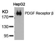 Western blot analysis of extracts from HepG2 cells using PDGF Receptor b(Ab-751) Antibody.