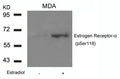Western blot analysis of extracts from MDA cells untreated or treated with Estradiol using Estrogen Receptor-a(Phospho-Ser118) Antibody.