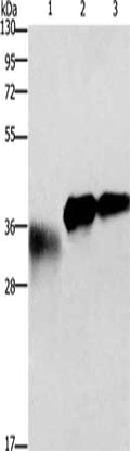 Gel: 10%SDS-PAGE, Lysate: 10 ng, 20 ng, Lane 1-3: Mouse testis tissue, 10 ng, 20 ng fusion protein, Primary antibody: CSB-PA829263(IL1B Antibody) at dilution 1/400, Secondary antibody: Goat anti rabbit IgG at 1/8000 dilution, Exposure time: 3 seconds