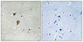 Immunohistochemical analysis of paraffin-embedded human brain tissue using HSF1 (Phospho-Thr142) antibody (left)or the same antibody preincubated with blocking peptide (right).
