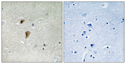Immunohistochemical analysis of paraffin-embedded human brain tissue using HSF1 (Phospho-Thr142) antibody (left)or the same antibody preincubated with blocking peptide (right).