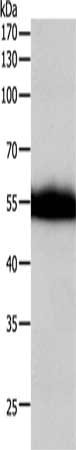 Gel: 10%SDS-PAGE, Lysate: 40 ug, Lane: A549 cells, Primary antibody: CSB-PA829543(F10 Antibody) at dilution 1/400, Secondary antibody: Goat anti rabbit IgG at 1/8000 dilution, Exposure time: 10 minutes