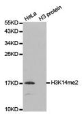 Western blot analysis of extracts of HeLa  and H3 protein, using H3K14me2 antibody.