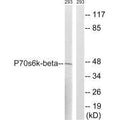 Western blot analysis of extracts from 293 cells, using p70 S6 Kinase β (Ab-423) antibody.