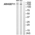 Western blot analysis of extracts from A549 cells and COLO 205 cells, using ARHGEF11 antibody.
