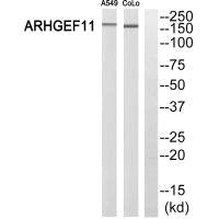 Western blot analysis of extracts from A549 cells and COLO 205 cells, using ARHGEF11 antibody.
