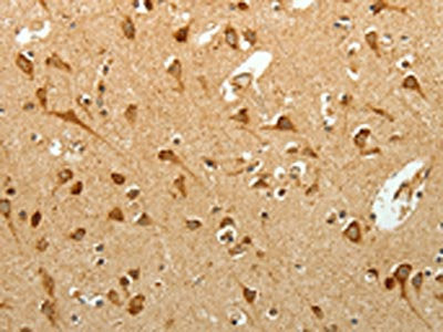 The image on the left is immunohistochemistry of paraffin-embedded Human brain tissue using CSB-PA830765(SELM Antibody) at dilution 1/25, on the right is treated with fusion protein. (Original magnification: ×200)