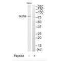 Western blot analysis of extracts from HeLa cells, using GUSB antibody.
