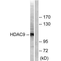 Western blot analysis of extracts from HepG2 cells, using HDAC9 antibody.