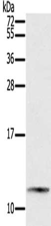 Gel: 12%SDS-PAGE, Lysate: 40 ug, Lane: Mouse small intestines tissue, Primary antibody: CSB-PA831475(PYY Antibody) at dilution 1/200, Secondary antibody: Goat anti rabbit IgG at 1/8000 dilution, Exposure time: 5 minutes