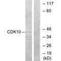 Western blot analysis of extracts from 293 cells, using CDK10 antibody.