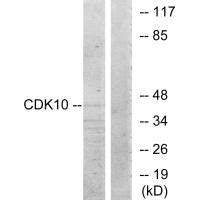 Western blot analysis of extracts from 293 cells, using CDK10 antibody.