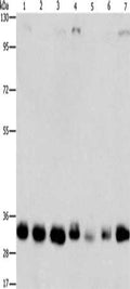 Gel: 8%SDS-PAGE, Lysate: 40 ug, Lane 1-7: 231 cells, 293T cells, Lovo cells, hepG2 cells, A549 cells, PC3 cells, A172 cells, Primary antibody: CSB-PA832374(MPG Antibody) at dilution 1/1500, Secondary antibody: Goat anti rabbit IgG at 1/8000 dilution, Exposure time: 1 minute