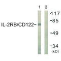 Western blot analysis of extracts from COS7 cells, using IL-2Rβ/CD122 (Ab-364) antibody.