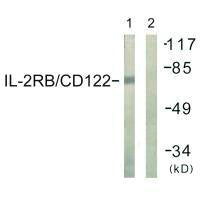 Western blot analysis of extracts from COS7 cells, using IL-2Rβ/CD122 (Ab-364) antibody.
