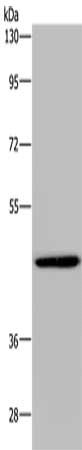 Gel: 8%SDS-PAGE, Lysate: 40 ug, Lane: A549 cells, Primary antibody: CSB-PA832628(GTPBP10 Antibody) at dilution 1/200, Secondary antibody: Goat anti rabbit IgG at 1/8000 dilution, Exposure time: 10 minutes