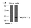 Western blot analysis of extracts from mouse brain tissue using Tau(Phospho-Thr231) Antibody and the same antibody preincubated with blocking peptide.