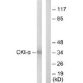 Western blot analysis of extracts from HeLa cells, using CKI-α antibody.