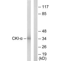 Western blot analysis of extracts from HeLa cells, using CKI-α antibody.