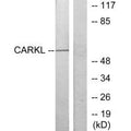 Western blot analysis of extracts from Jurkat cells, using CARKL antibody.