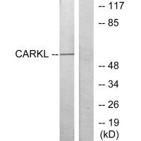 Western blot analysis of extracts from Jurkat cells, using CARKL antibody.