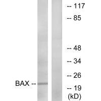 Western blot analysis of extracts from HepG2 cells, using Bax (Ab-167) antibody.