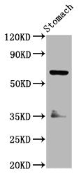 Western Blot
Positive WB detected in: Rat stomach tissue
All lanes: SLC5A5 antibody at 3.7ug/ml
Secondary
Goat polyclonal to rabbit IgG at 1/50000 dilution
Predicted band size: 69 kDa
Observed band size: 69 kDa