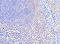 Immunohistochemistry of paraffin-embedded human tonsil tissue using CSB-PA835890ESR1HU at dilution of 1:100