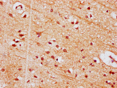 IHC image of CSB-PA836170LA01HU diluted at 1:500 and staining in paraffin-embedded human brain tissue performed on a Leica BondTM system. After dewaxing and hydration, antigen retrieval was mediated by high pressure in a citrate buffer (pH 6.0). Section was blocked with 10% normal goat serum 30min at RT. Then primary antibody (1% BSA) was incubated at 4°C overnight. The primary is detected by a biotinylated secondary antibody and visualized using an HRP conjugated SP system.
