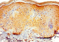 Immunohistochemistry of paraffin-embedded human skin tissue using CSB-PA836205ESR2HU at dilution of 1:100