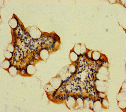 Immunohistochemistry of paraffin-embedded human small intestine tissue using CSB-PA836205LA01HU at dilution of 1:100