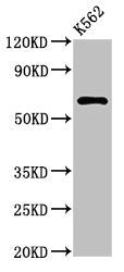 Western Blot
Positive WB detected in: K562 whole cell lysate
All lanes: MARS2 antibody at 3ug/ml
Secondary
Goat polyclonal to rabbit IgG at 1/50000 dilution
Predicted band size: 67 kDa
Observed band size: 67 kDa