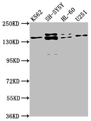 Western Blot
Positive WB detected in: K562 whole cell lysate, SH-SY5Y whole cell lysate, HL-60 whole cell lysate, U251 whole cell lysate
All lanes: AHI1 antibody at 1:2000
Secondary
Goat polyclonal to rabbit IgG at 1/50000 dilution
Predicted band size: 138, 121, 71 kDa
Observed band size: 138 kDa