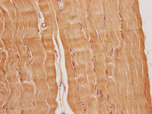 IHC image of CSB-PA836707OA01HU diluted at 1:200 and staining in paraffin-embedded human heart tissue performed on a Leica BondTM system. After dewaxing and hydration, antigen retrieval was mediated by high pressure in a citrate buffer (pH 6.0). Section was blocked with 10% normal goat serum 30min at RT. Then primary antibody (1% BSA) was incubated at 4°C overnight. The primary is detected by a Goat anti-rabbit polymer IgG labeled by HRP and visualized using 0.05% DAB.