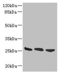 Western blot
All lanes: DNAJB8 antibody at 8µg/ml
Lane 1: Hela whole cell lysate
Lane 2: Mouse brain tissue
Lane 3: Mouse liver tissue
Secondary
Goat polyclonal to rabbit IgG at 1/10000 dilution
Predicted band size: 26 kDa
Observed band size: 26 kDa