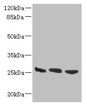 Western blot
All lanes: DNAJB8 antibody at 8µg/ml
Lane 1: Hela whole cell lysate
Lane 2: Mouse brain tissue
Lane 3: Mouse liver tissue
Secondary
Goat polyclonal to rabbit IgG at 1/10000 dilution
Predicted band size: 26 kDa
Observed band size: 26 kDa