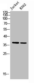 Western blot analysis of JK K562 using NHERF-2 antibody.. Secondary antibody  was diluted at 1:20000