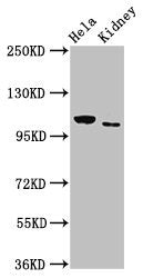 Western Blot
Positive WB detected in: Hela whole cell lysate, Rat kidney tissue
All lanes: NEK9 antibody at 3µg/ml
Secondary
Goat polyclonal to rabbit IgG at 1/50000 dilution
Predicted band size: 108 kDa
Observed band size: 108 kDa