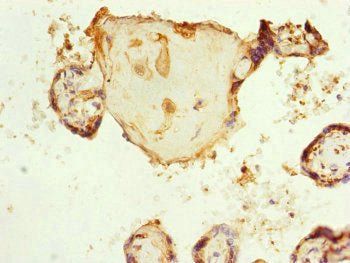 Immunohistochemistry of paraffin-embedded human placenta tissue using CSB-PA837849DSR1HU at dilution of 1:100