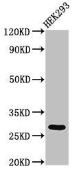 Western Blot
Positive WB detected in: HEK293 whole cell lysate
All lanes: ANKRD49 antibody at 3µg/ml
Secondary
Goat polyclonal to rabbit IgG at 1/50000 dilution
Predicted band size: 28 kDa
Observed band size: 28 kDa