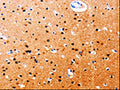 The image on the left is immunohistochemistry of paraffin-embedded Human brain tissue using CSB-PA838764(GDI1 Antibody) at dilution 1/20, on the right is treated with fusion protein. (Original magnification: ×200)