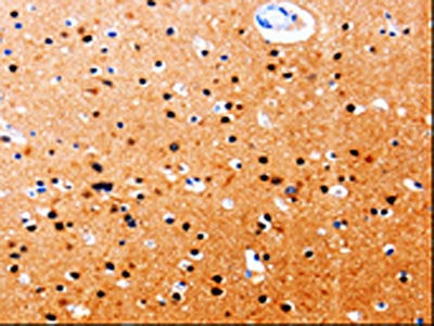 The image on the left is immunohistochemistry of paraffin-embedded Human brain tissue using CSB-PA838764(GDI1 Antibody) at dilution 1/20, on the right is treated with fusion protein. (Original magnification: ×200)