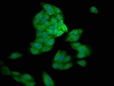 Immunofluorescence staining of HepG2 cells with CSB-PA838815LA01HU at 1:200, counter-stained with DAPI. The cells were fixed in 4% formaldehyde, permeabilized using 0.2% Triton X-100 and blocked in 10% normal Goat Serum. The cells were then incubated with the antibody overnight at 4&deg;C. The secondary antibody was Alexa Fluor 488-congugated AffiniPure Goat Anti-Rabbit IgG(H+L).