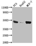 Western Blot
Positive WB detected in: PC3 whole cell lysate, HepG2 whole cell lysate, MCF-7 whole cell lysate
All lanes: TNFRSF25 antibody at 1:2000
Secondary
Goat polyclonal to rabbit IgG at 1/50000 dilution
Predicted band size: 46, 24, 28, 20, 15, 14, 26, 41, 42, 30 kDa
Observed band size: 46 kDa