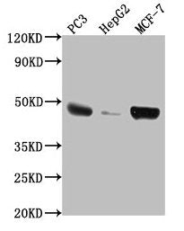 Western Blot
Positive WB detected in: PC3 whole cell lysate, HepG2 whole cell lysate, MCF-7 whole cell lysate
All lanes: TNFRSF25 antibody at 1:2000
Secondary
Goat polyclonal to rabbit IgG at 1/50000 dilution
Predicted band size: 46, 24, 28, 20, 15, 14, 26, 41, 42, 30 kDa
Observed band size: 46 kDa