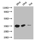Western Blot
Positive WB detected in: recombinant protein
All lanes: MTB Antibody at 1:1000
Secondary
Goat polyclonal to rabbit IgG at 1/50000 dilution
Predicted band size: 33 kDa
Observed band size: 33 kDa