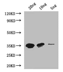 Western Blot
Positive WB detected in: recombinant protein
All lanes: MTB Antibody at 1:1000
Secondary
Goat polyclonal to rabbit IgG at 1/50000 dilution
Predicted band size: 33 kDa
Observed band size: 33 kDa