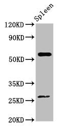 Western Blot
Positive WB detected in: Mouse spleen tissue
All lanes: ACD antibody at 4ug/ml
Secondary
Goat polyclonal to rabbit IgG at 1/50000 dilution
Predicted band size: 58 kDa
Observed band size: 58 kDa